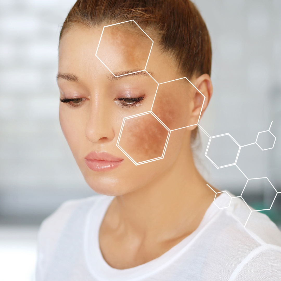 Semi-permanent beauty spot at Snatch & Glow Dubai