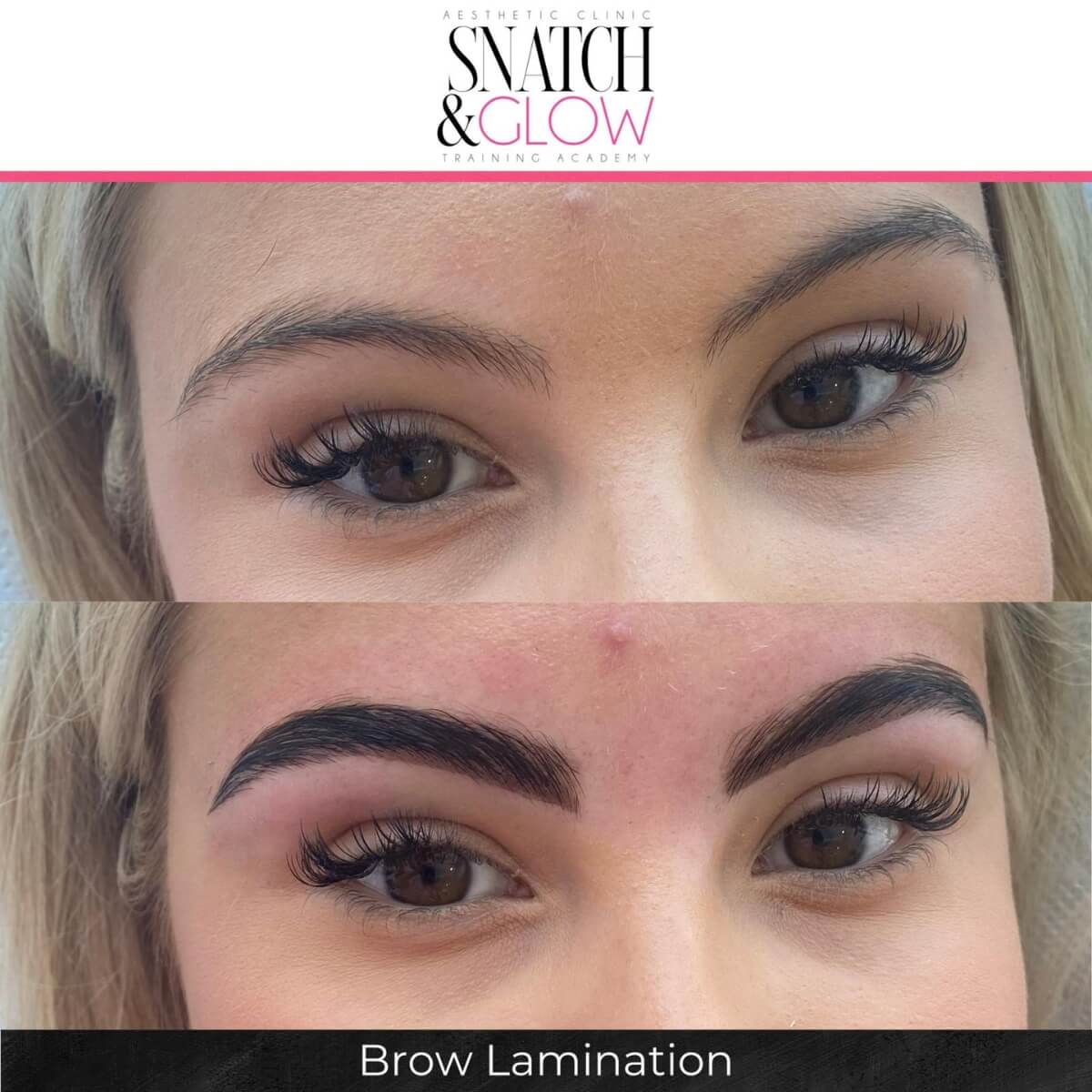 Combination brows treatment at Snatch & Glow Dubai